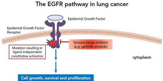 EGFR-pathway-in-lung-cancer.jpg